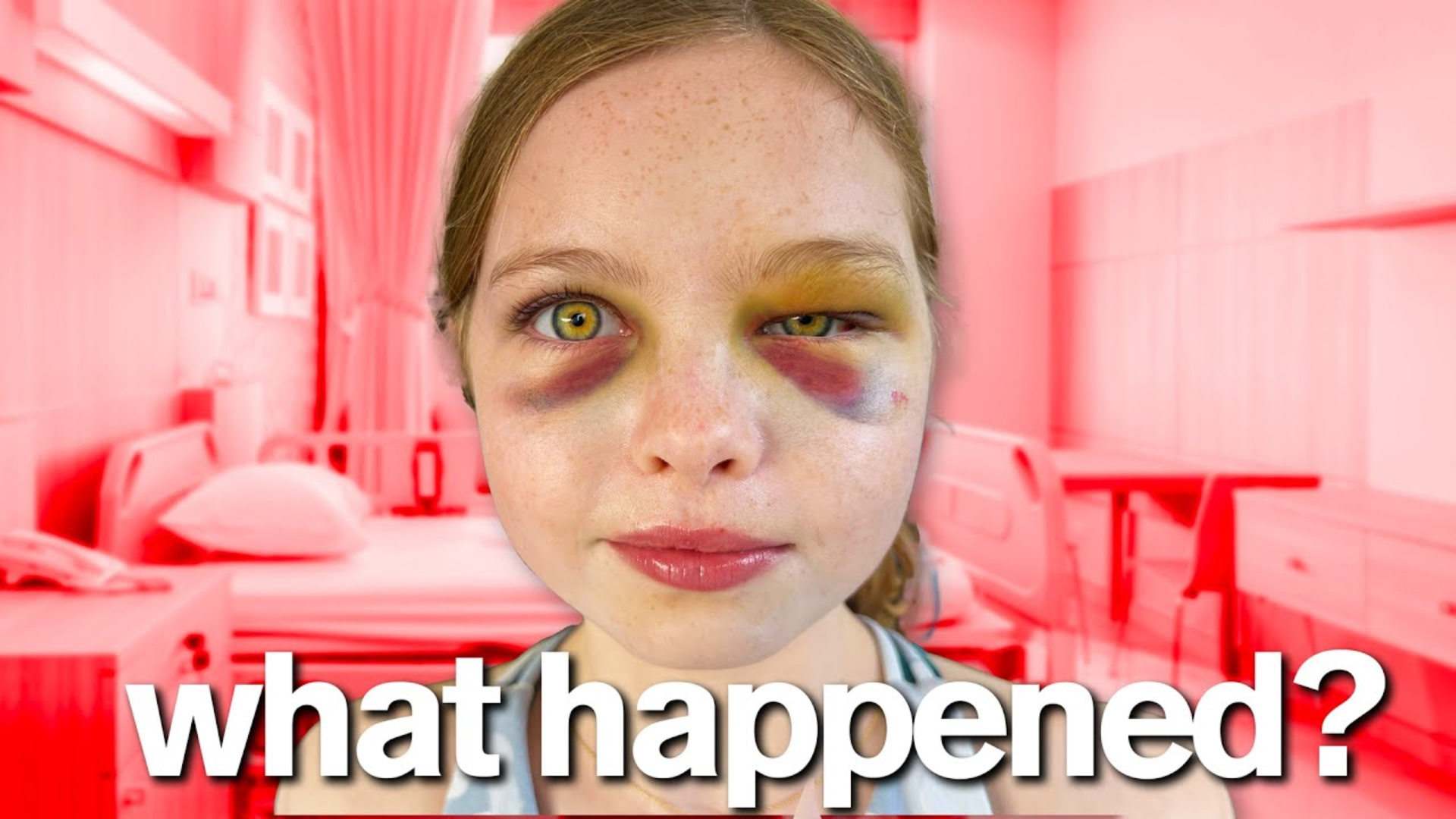 The Day of My Accident – What REALLY Happened!